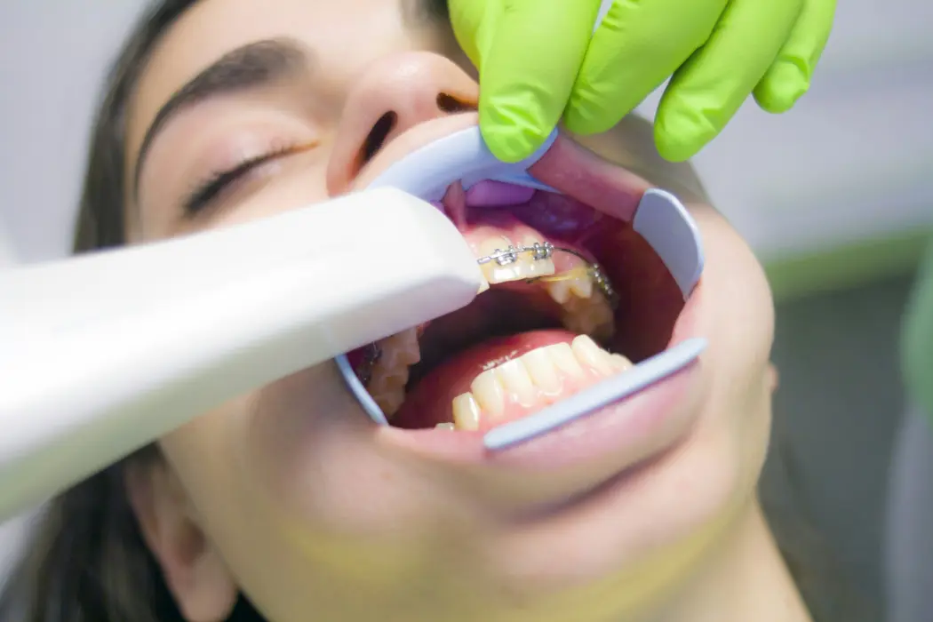 Implanty zębowe Legnica – pierwszy krok do śnieżnobiałego uśmiechu!